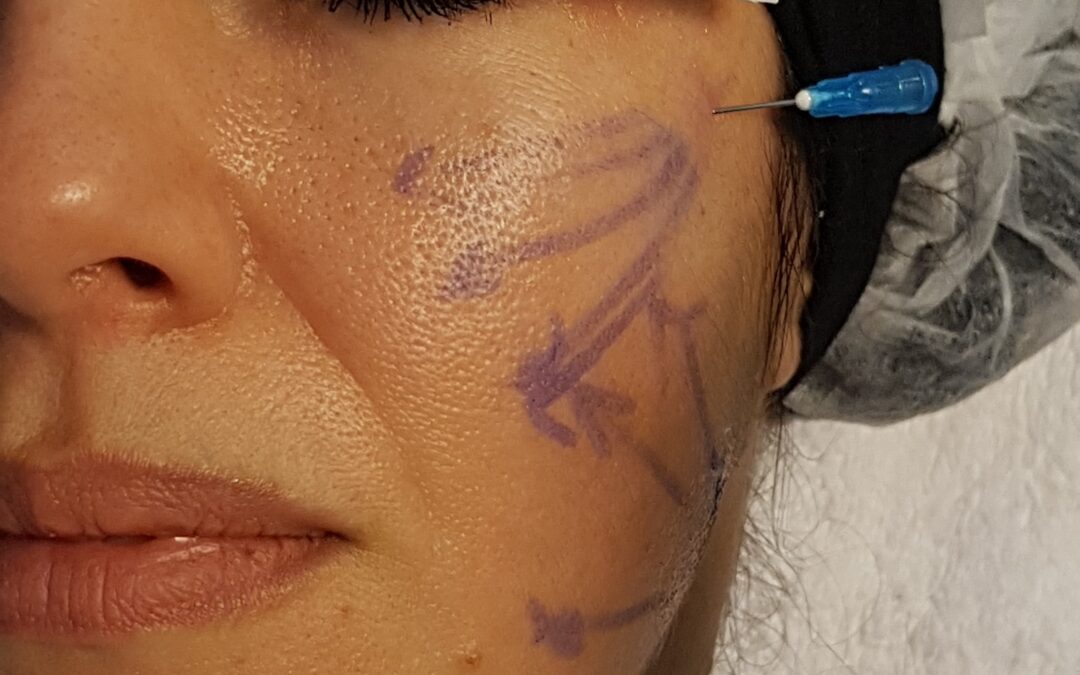 Tendencias en Medicina Estética en Colombia: Rejuveneciendo con Naturalidad